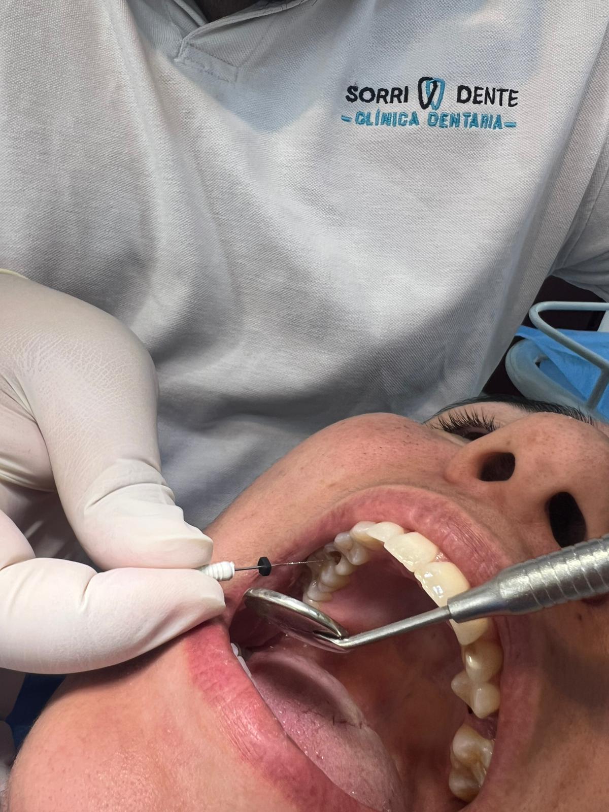 Endodontia