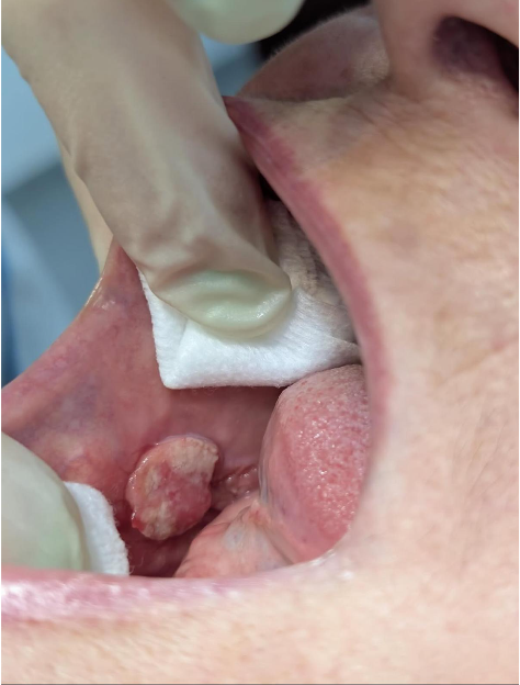 Patologia Oral
