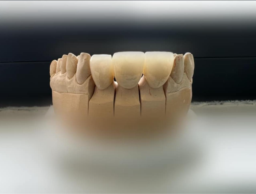 Próteses Dentárias